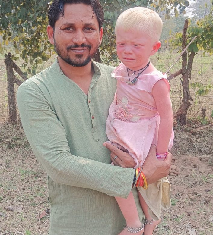 खूबसूरत विदेशी चेहरा आदिवासी बेटी भावना से समाजसेवी ने किया मुलाकात